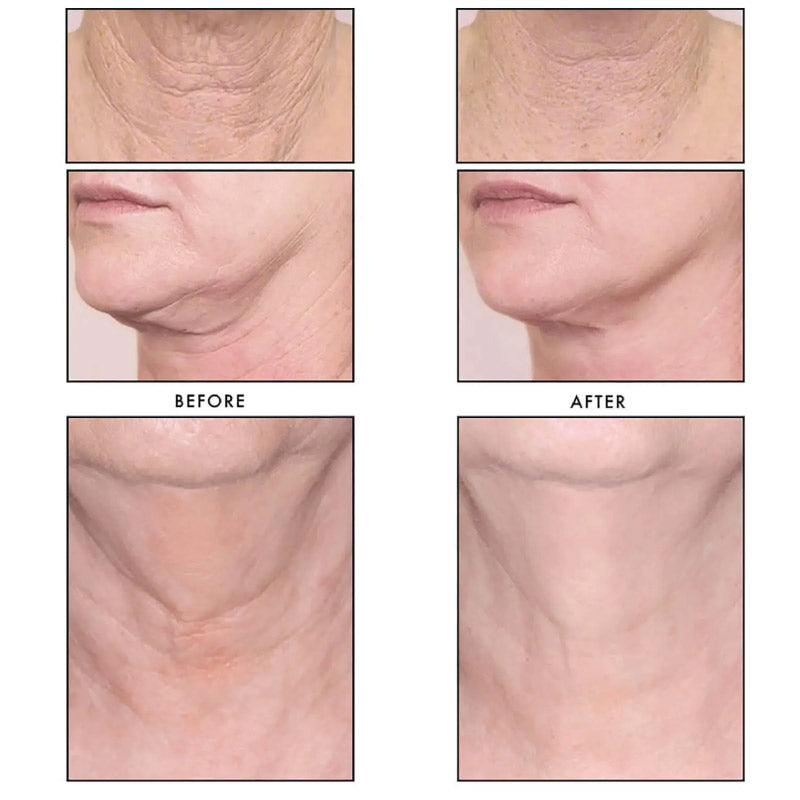 Revision Skincare® Nectifirm