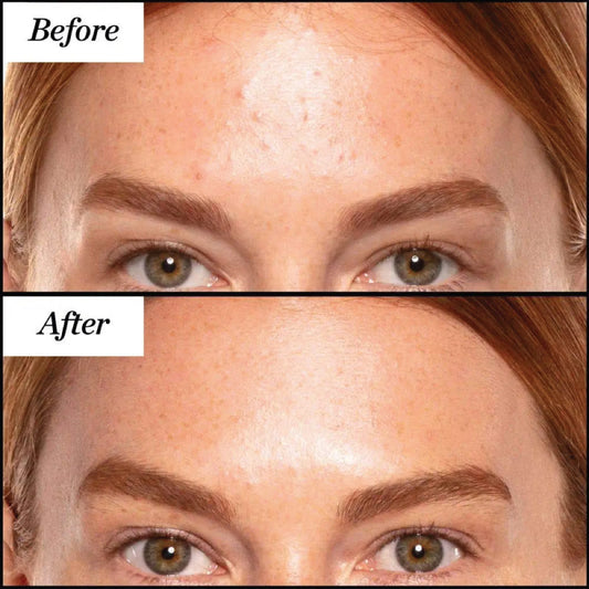 Sunday Riley A+ High-Dose Retinol Serum